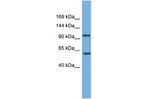 WB Suggested Anti-PI4KB Antibody Titration: 0. (PI4KB 抗体  (Middle Region))