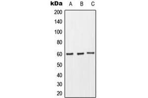 Western blot analysis of CD89 expression in THP1 (A), Raw264. (FCAR 抗体  (Center))