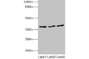 Western blot All lanes: CRYZL1 antibody at 12 μg/mL Lane 1: Hela whole cell lysate Lane 2: HepG2 whole cell lysate Lane 3: Jurkat whole cell lysate Secondary Goat polyclonal to rabbit IgG at 1/10000 dilution Predicted band size: 39, 22 kDa Observed band size: 39 kDa (CRYZL1 抗体  (AA 1-87))