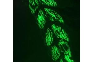 Image no. 2 for anti-Actin, alpha 1, Skeletal Muscle (ACTA1) antibody (ABIN1502284) (Actin 抗体)