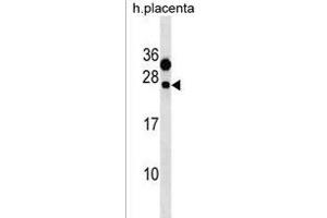 CLEC6A Antibody (C-term) (ABIN1536706 and ABIN2850181) western blot analysis in human placenta tissue lysates (35 μg/lane). (C-Type Lectin Domain Family 6, Member A (CLEC6A) (AA 137-163), (C-Term) 抗体)