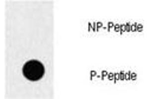 Dot blot analysis of p-EGFR antibody. (EGFR 抗体  (pTyr1069))