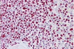 Immunohistochemistry (IHC) image for anti-Atonal Homolog 1 (Drosophila) (ATOH1) (Middle Region) antibody (ABIN2779592) (ATOH1 抗体  (Middle Region))