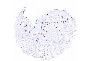 Strong CD1 immunostaining of Langerhans cells in squamous epithelium of the skin (Recombinant CD1a 抗体)