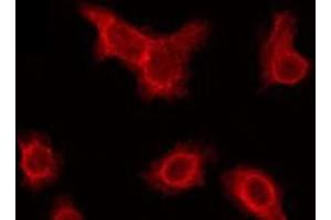 ABIN6275818 staining Hela by IF/ICC. (Cytochrome P450 2A6V2 抗体)
