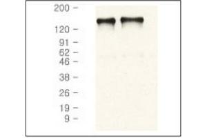 Western Blotting (WB) image for anti-Epidermal Growth Factor Receptor (EGFR) antibody (ABIN371623) (EGFR 抗体)