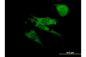 Immunofluorescence (IF) image for anti-Sodium Channel, Voltage-Gated, Type VIII, alpha (SCN8A) (AA 1854-1951) antibody (ABIN520023)