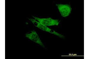 Immunofluorescence of monoclonal antibody to SCN8A on NIH/3T3 cell. (SCN8A 抗体  (AA 1854-1951))
