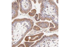 Immunohistochemical staining of human placenta with BGN polyclonal antibody  strong cytoplasmic positivity in trophoblastic cells.