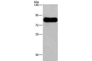Western Blot analysis of Mouse brain tissue using SYN1 Polyclonal Antibody at dilution of 1:650 (SYN1 抗体)