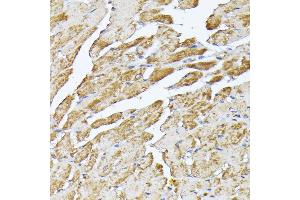 Immunohistochemistry of paraffin-embedded mouse heart using SLC25 antibody (ABIN7270430) at dilution of 1:100 (40x lens). (SLC25A5 抗体  (AA 150-250))