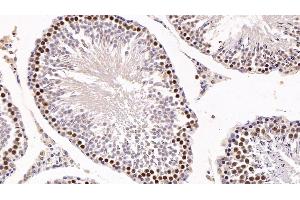 Detection of KPNa2 in Rat Testis Tissue using Polyclonal Antibody to Karyopherin Alpha 2 (KPNa2) (KPNA2 抗体  (AA 157-412))