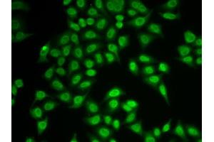 Immunofluorescence analysis of MCF-7 cell using PSMB9 antibody. (PSMB9 抗体  (AA 1-219))