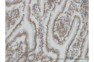 Immunoperoxidase of monoclonal antibody to SP110 on formalin-fixed paraffin-embedded human small Intestine. (SP110 抗体  (AA 271-380))