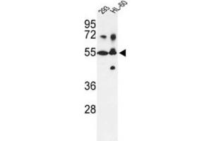 Western Blotting (WB) image for anti-Cytochrome P450, Family 21, Subfamily A, Polypeptide 2 (CYP21A2) antibody (ABIN3003551) (CYP21A2 抗体)