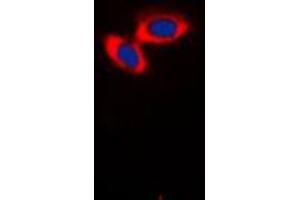Immunofluorescent analysis of CD3d staining in Jurkat cells. (CD3D 抗体  (Center))