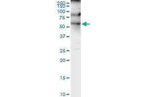 Immunoprecipitation of HNF4A transfected lysate using anti-HNF4A MaxPab rabbit polyclonal antibody and Protein A Magnetic Bead , and immunoblotted with HNF4A purified MaxPab mouse polyclonal antibody (B01P) . (HNF4A 抗体  (AA 1-464))