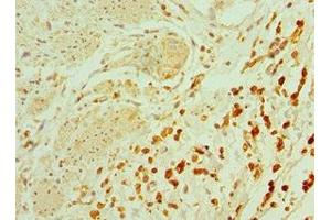 Immunohistochemistry of paraffin-embedded human epityphlon tissue using ABIN7164900 at dilution of 1:100 (TAC1 抗体  (AA 1-129))