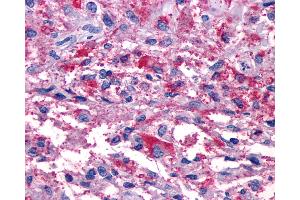 Immunohistochemistry (IHC) image for anti-Purinergic Receptor P2Y, G-Protein Coupled, 11 (P2RY11) (Cytoplasmic Domain) antibody (ABIN1049204)