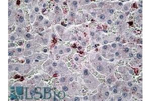 ABIN570794 (6µg/ml) staining of paraffin embedded Human Liver. (CCL20 抗体  (Internal Region))