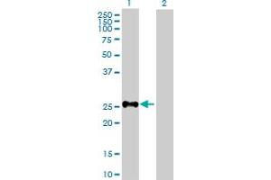 Western Blot analysis of SHOX expression in transfected 293T cell line by SHOX MaxPab polyclonal antibody. (SHOX 抗体  (AA 1-225))