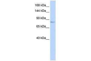 WB Suggested Anti-EVI1 Antibody Titration: 0. (MECOM 抗体  (N-Term))