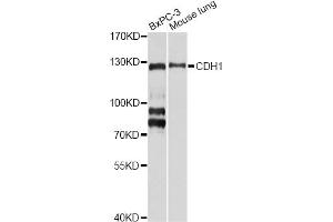 Western blot analysis of extracts of various cell lines, using CDH1 antibody (ABIN5971558) at 1/1000 dilution. (E-cadherin 抗体)