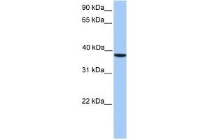 CK2 alpha antibody used at 1 ug/ml to detect target protein. (CSNK2A1/CK II alpha 抗体  (C-Term))