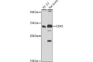 Western Blotting (WB) image for anti-Cyclin-Dependent Kinase 5 (CDK5) (AA 1-292) antibody (ABIN6138319)