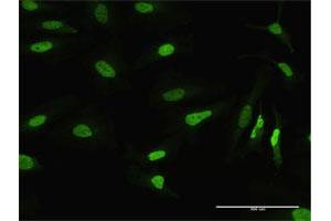 Immunofluorescence (IF) image for anti-Mismatch Repair Protein 2 (MSH2) (AA 1-934) antibody (ABIN518021)