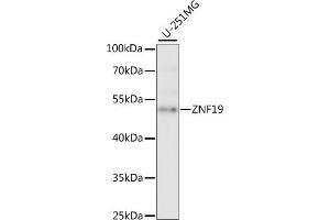 Western blot analysis of extracts of U-251MG cells, using ZNF19 antibody (ABIN7271464) at 1:1000 dilution. (ZNF19 抗体  (AA 1-180))