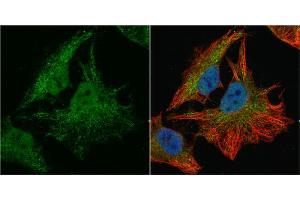 ICC/IF Image SOD1 antibody detects SOD1 protein at cytoplasm and nucleus by immunofluorescent analysis. (SOD1 抗体  (C-Term))