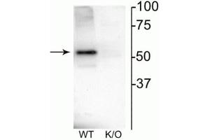 Western blot of mouse habenula lysate showing specific immunolabeling of the ~52 kDa nAChRβ4 protein. (CHRNB4 抗体  (Cytoplasmic Loop))