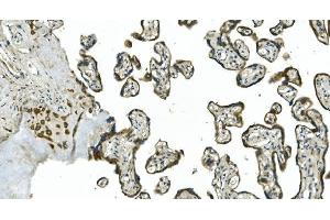 IHC analysis of CDC123 using anti-CDC123 antibody (ABIN7599284).