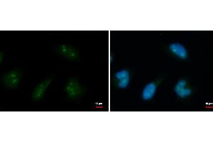 ICC/IF Image DDX18 antibody detects DDX18 protein at nucleolus by immunofluorescent analysis. (DDX18 抗体  (Center))