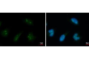 ICC/IF Image DDX18 antibody detects DDX18 protein at nucleolus by immunofluorescent analysis.