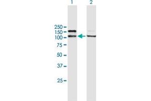 Western Blot analysis of ADAR expression in transfected 293T cell line by ADAR MaxPab polyclonal antibody.