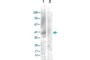 HEK293 overexpressing CNR1 and probed with CNR1 polyclonal antibody  (mock transfection in second lane), tested by Origene. (CNR1 抗体)