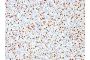 Immunohistochemistry (IHC) image for anti-Spleen Focus Forming Virus (SFFV) Proviral Integration Oncogene Spi1 (SPI1) (AA 16-170) antibody (ABIN6940631)