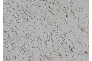 ABIN6278405 at 1/100 staining Human kidney tissue by IHC-P. (SUV39H1 抗体  (C-Term))