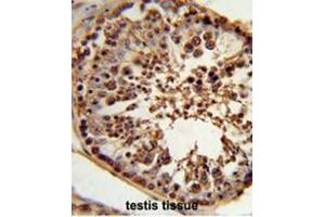 Immunohistochemistry (Paraffin-embedded Sections) (IHC (p)) image for anti-Centrosome and Spindle Pole Associated Protein 1 (Cspp1) (AA 276-306), (N-Term) antibody (ABIN951713)