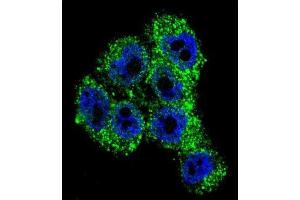 Immunofluorescence (IF) image for anti-Transient Receptor Potential Cation Channel, Subfamily M, Member 8 (TRPM8) antibody (ABIN2996363) (TRPM8 抗体)