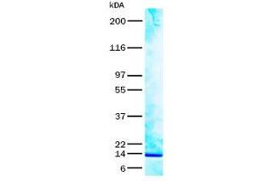 Validation with Western Blot (RSPO2 蛋白)
