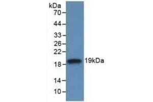 Detection of Recombinant IL18BP, Human using Monoclonal Antibody to Interleukin 18 Binding Protein (IL18BP) (IL18BP 抗体  (AA 31-194))