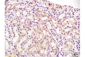 Formalin-fixed and paraffin embedded mouse kidney labeled with Anti OAT-1/SLC22A6 Polyclonal Antibody, Unconjugated (ABIN670791) at 1:200 followed by conjugation to the secondary antibody and DAB staining.