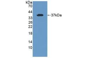 Detection of Recombinant TFR2, Human using Polyclonal Antibody to Transferrin Receptor 2 (TFR2) (Transferrin Receptor 2 抗体  (AA 493-784))