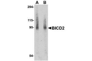 Western blot analysis of BICD2 in A549 cell lysate with AP30146PU-N BICD2 antibody at (A) 1 and (B) 2 μg/ml. (BICD2 抗体  (Center))