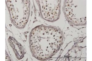 Immunoperoxidase of monoclonal antibody to IRF5 on formalin-fixed paraffin-embedded human testis. (IRF5 抗体  (AA 395-504))