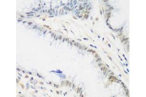 Immunohistochemistry of paraffin-embedded Human stomach using IGF2BP3 Polyclonal Antibody at dilution of 1:200 (40x lens). (IGF2BP3 抗体)