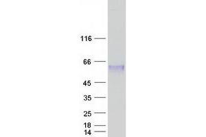 CLN5 Protein (Myc-DYKDDDDK Tag)